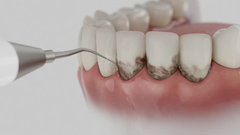 Reliable Dental contractor in Monte Sereno, CA by Dentist Open Now
